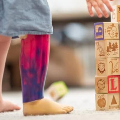 Prosthesis for children